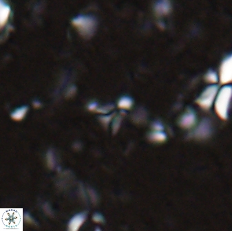 Sphenolithus tintinnabulum 28155