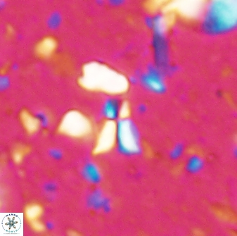 Sphenolithus tintinnabulum 28182