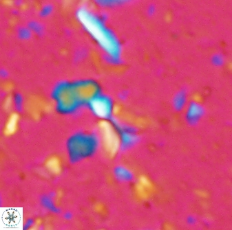 Sphenolithus tintinnabulum 28183