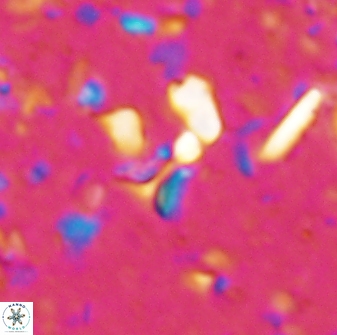 Sphenolithus tintinnabulum 28187