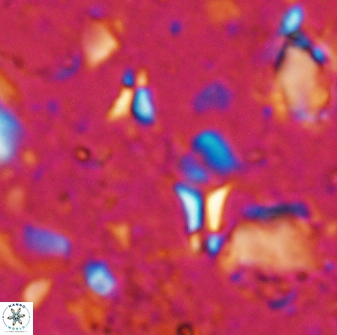 Sphenolithus tintinnabulum 28199
