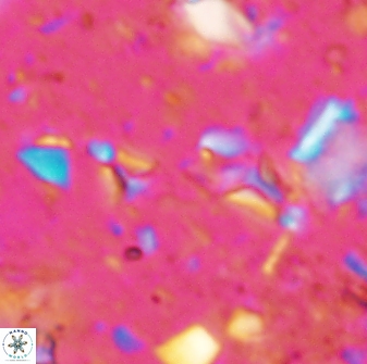 Sphenolithus tintinnabulum 28204