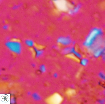 Sphenolithus tintinnabulum 28205