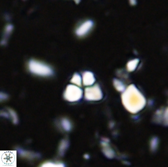 Sphenolithus trigonikos 42829