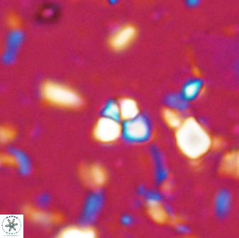 Sphenolithus trigonikos 42830