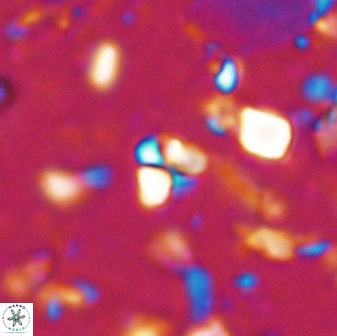 Sphenolithus trigonikos 42832