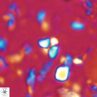 Sphenolithus trigonikos 42833