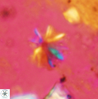 Sphenolithus umbrellus 2452