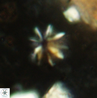 Sphenolithus umbrellus 2453