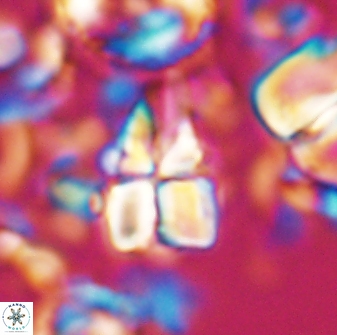 Sphenolithus villae 22648