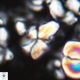 Sphenolithus villae 22651