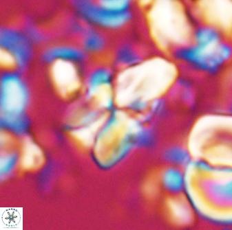 Sphenolithus villae 22652