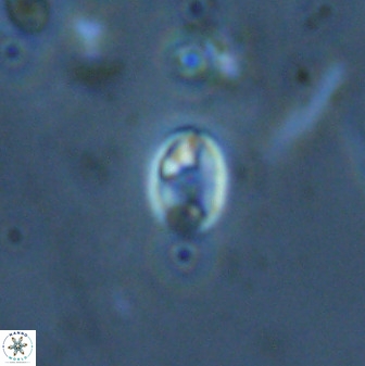 Swapansahooia maghredaswampensis 35265