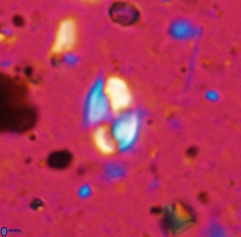 Swapansahooia maghredaswampensis 36071