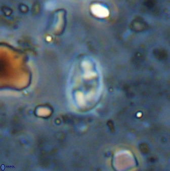 Swapansahooia maghredaswampensis 36082