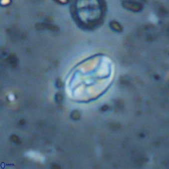 Swapansahooia maghredaswampensis 37884