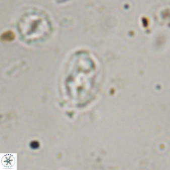 Swapansahooia maghredaswampensis 37885