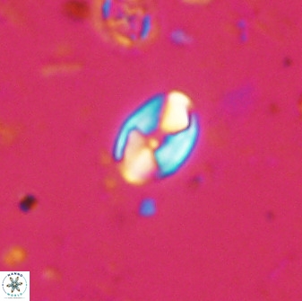 Swapansahooia maghredaswampensis 37889