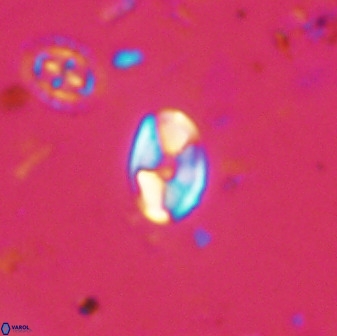 Swapansahooia maghredaswampensis 37890