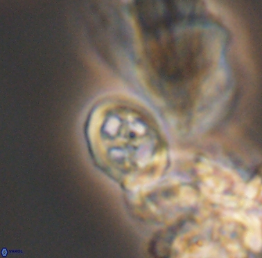 Staurolithites peristrefomeno 2335