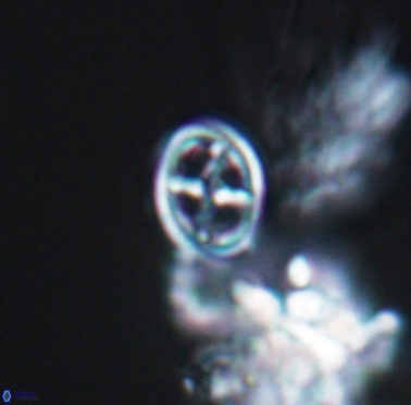 Staurolithites peristrefomeno 2330