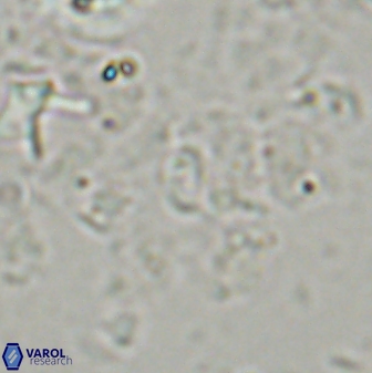 Syracosphaera oneillii 43451
