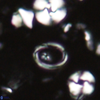 Syracosphaera clathrata VR 026968