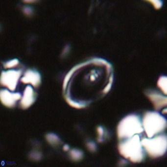 Syracosphaera clathrata VR 026970