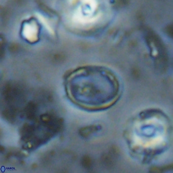 Syracosphaera clathrata VR 026980