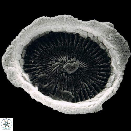 Syracosphaera pulchra 1466 31