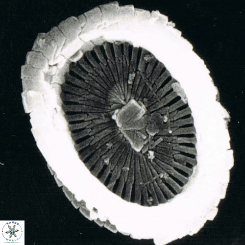 Syracosphaera pulchra 1473 5
