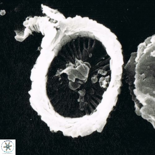 Syracosphaera pulchra 1473 7