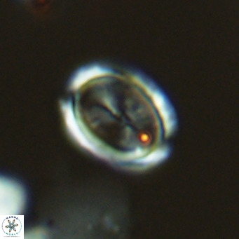 Syracosphaera pulchra VR 10869