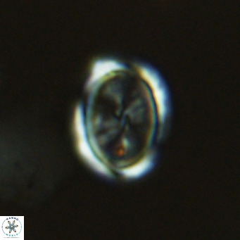 Syracosphaera pulchra VR 10872