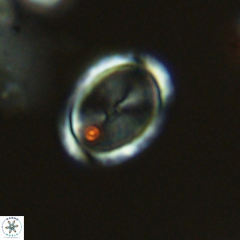 Syracosphaera pulchra VR 10873