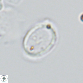 Syracosphaera pulchra VR 10877