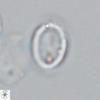 Syracosphaera pulchra VR 10879