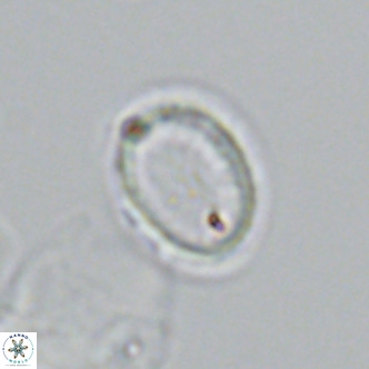 Syracosphaera pulchra VR 10880