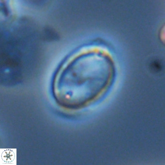 Syracosphaera pulchra VR 10884