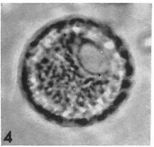 Cervisiella operculata 13829