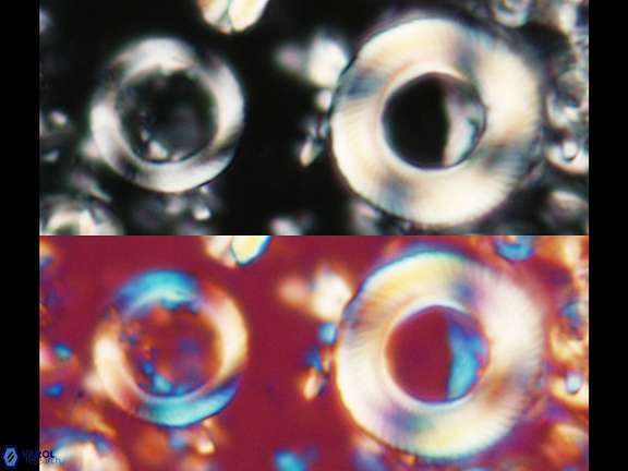 T davidia T deniseae