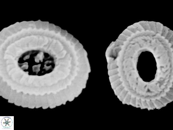 T pertusus distal