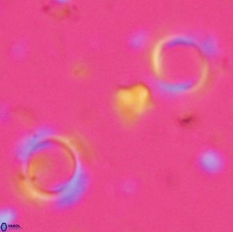 Tenebrislaminam aequiscutum 26911