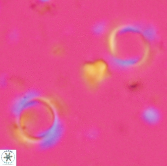 Tenebrislaminam aequiscutum 26911