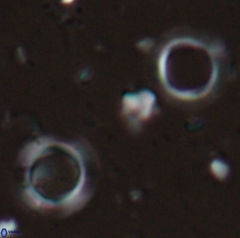 Tenebrislaminam aequiscutum 26913