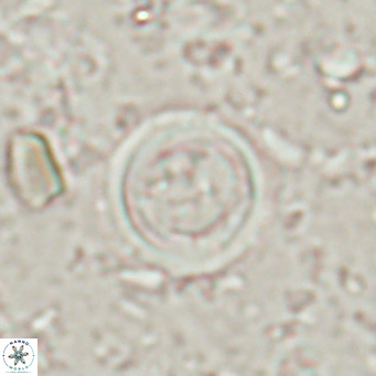 Tenebrislaminam bramlettei VR 025234