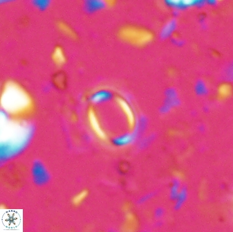 Tenebrislaminam detectus 27915