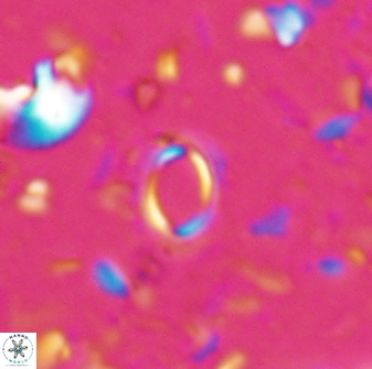Tenebrislaminam detectus 27916