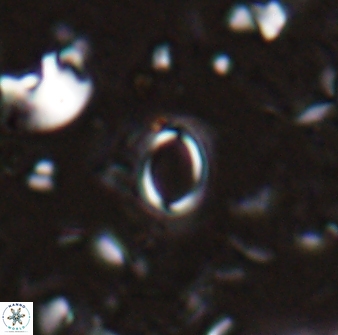 Tenebrislaminam detectus 27917