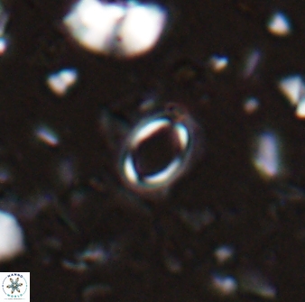 Tenebrislaminam detectus 27918
